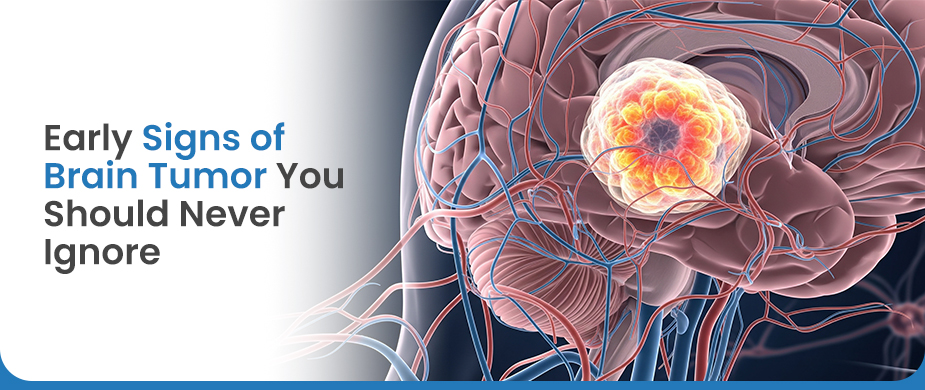 Early Signs of Brain Tumor You Should Never Ignore